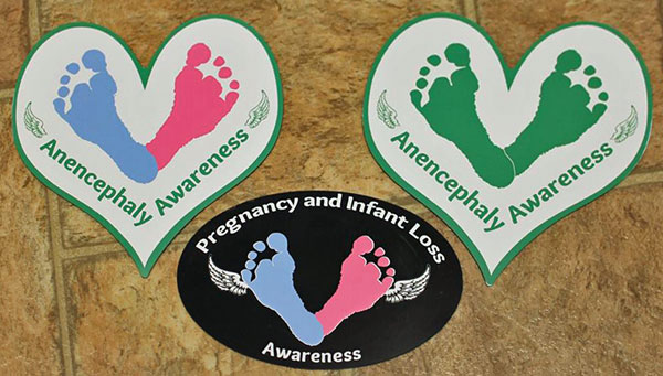 Pregnancy and Infant Loss Awareness / Anencephaly Awareness